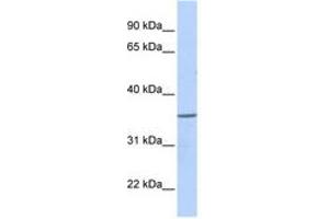 Image no. 1 for anti-Zinc Finger Protein 688 (ZNF688) (AA 108-157) antibody (ABIN6740519) (ZNF688 anticorps  (AA 108-157))