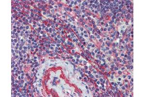 Immunohistochemistry (IHC) image for anti-Multiple C2 Domains, Transmembrane 1 (MCTP1) (Middle Region) antibody (ABIN2781866) (MCTP1 anticorps  (Middle Region))