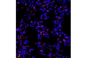 Immunofluorescence of paraffin embedded mouse lung using NSFL1C (ABIN7074865) at dilution of 1:650 (400x lens)