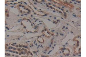 Detection of GCLM in Human Kidney Tissue using Polyclonal Antibody to Glutamate Cysteine Ligase, Modifier Subunit (GCLM) (GCLM anticorps  (AA 40-251))