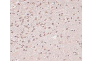 Immunohistochemistry of paraffin-embedded Mouse brain using PRPF31 Polyclonal Antibody at dilution of 1:100 (40x lens). (PRPF31 anticorps)