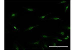 Immunofluorescence of monoclonal antibody to RAX on HeLa cell.