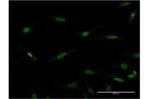Immunofluorescence of monoclonal antibody to RAX on HeLa cell. (RAX anticorps  (AA 253-346))