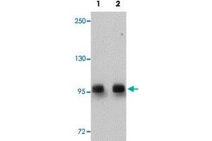Western blot analysis of rat brain tissue with DCLK2 polyclonal antibody  at (Lane 1) 1 and (Lane 2) 2 ug/mL dilution. (DCLK2 anticorps  (C-Term))