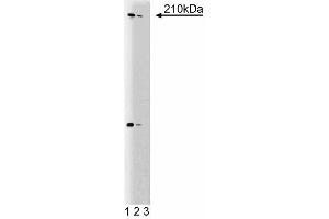 Western blot analysis of GMAP-210 on Jurkat lysate.
