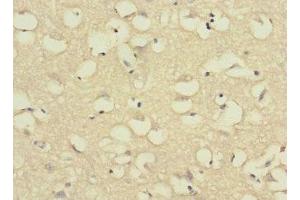 Immunohistochemistry of paraffin-embedded human brain tissue using ABIN7175065 at dilution of 1:100 (C11orf1 anticorps  (AA 33-150))