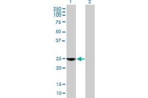 Western Blot analysis of ORM1 expression in transfected 293T cell line by ORM1 MaxPab polyclonal antibody.