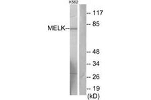 Western blot analysis of extracts from K562 cells, using MELK Antibody. (MELK anticorps  (AA 431-480))