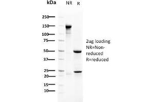 SDS-PAGE Analysis Purified RAD51 Mouse Monoclonal Antibody (RAD51/2702). (RAD51 anticorps  (AA 1-134))