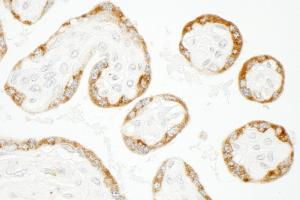 Immunohistochemistry (IHC) image for anti-Cytoskeleton-Associated Protein 4 (CKAP4) (AA 500-550) antibody (ABIN7448940)