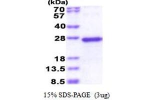 SDS-PAGE (SDS) image for NADH Dehydrogenase (Ubiquinone) Fe-S Protein 5, 15kDa (NADH-Coenzyme Q Reductase) (NDUFS5) (AA 1-106) protein (His tag) (ABIN5853540)