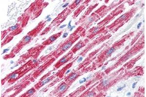 Human Heart (formalin-fixed, paraffin-embedded) stained with FOXA3 antibody ABIN214752 at 5 ug/ml followed by biotinylated goat anti-rabbit IgG secondary antibody ABIN481713, alkaline phosphatase-streptavidin and chromogen.