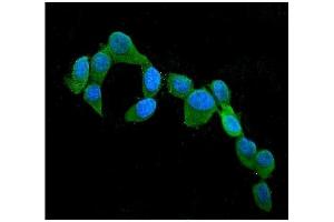 IF analysis of CST3 using anti-CST3 antibody (ABIN6719299). (CST3 anticorps  (AA 31-146))