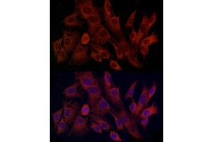 Immunofluorescence analysis of C6 cells using TIMM8A Rabbit pAb (ABIN6129145, ABIN6149172, ABIN6149173 and ABIN6225114) at dilution of 1:100 (40x lens). (TIMM8A/DDP anticorps  (AA 1-97))