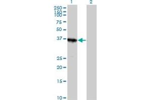 Western Blot analysis of ABT1 expression in transfected 293T cell line by ABT1 MaxPab polyclonal antibody. (Activator of Basal Transcription 1 anticorps  (AA 1-272))