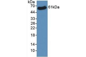 Detection of Recombinant VDAC1, Human using Monoclonal Antibody to Voltage Dependent Anion Channel Protein 1 (VDAC1)