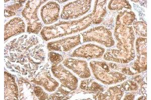 IHC-P Image CYP24A1 antibody detects CYP24A1 protein at cytosol on mouse kidney by immunohistochemical analysis.
