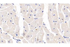 Detection of CALR in Human Cardiac Muscle Tissue using Polyclonal Antibody to Calreticulin (CALR) (Calreticulin anticorps  (AA 18-193))