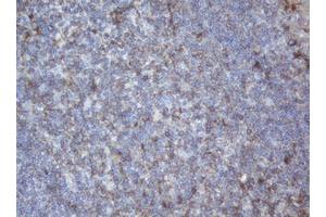 Image no. 1 for anti-Palmitoyl-Protein Thioesterase 1 (PPT1) (AA 100-306) antibody (ABIN1490802)