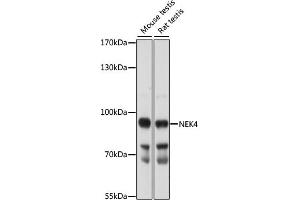 Western blot analysis of extracts of various cell lines, using NEK4 antibody (ABIN7268917) at 1:1000 dilution.