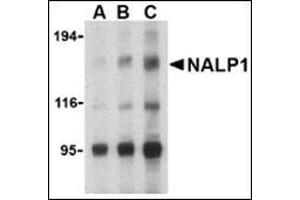 Western blot analysis of NALP1 in U937 cell lysate with this product at (A) 1, (B) 2 and (C) 4 μg/ml. (NLRP1 anticorps  (C-Term))