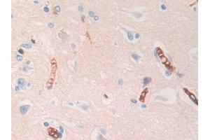 Detection of HBd in Human Cerebrum Tissue using Polyclonal Antibody to Hemoglobin Delta (HBd)