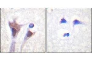 Immunohistochemistry analysis of paraffin-embedded human brain, using 14-3-3 zeta/delta (Phospho-Thr232) Antibody.