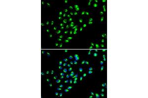 Immunofluorescence analysis of MCF7 cell using GOLM1 antibody. (GOLM1 anticorps)