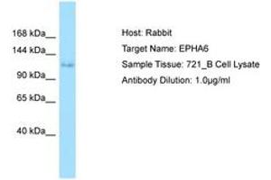 Image no. 1 for anti-EPH Receptor A6 (Epha6) (AA 313-362) antibody (ABIN6749998) (EPH Receptor A6 anticorps  (AA 313-362))