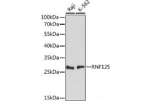 Western blot analysis of extracts of various cell lines using RNF125 Polyclonal Antibody at dilution of 1:1000. (RNF125 anticorps)