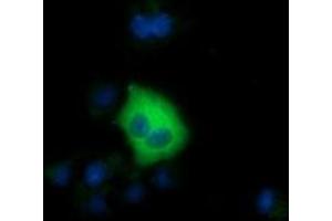 Anti-SDR9C7 mouse monoclonal antibody (ABIN2453633) immunofluorescent staining of COS7 cells transiently transfected by pCMV6-ENTRY SDR9C7 (RC210941). (SDR9C7 anticorps)
