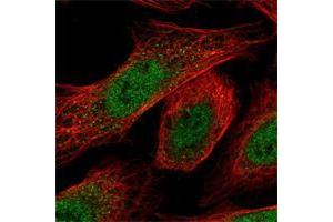 Immunofluorescent staining of human cell line U-2 OS shows positivity in nucleus but not nucleoli.