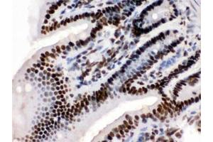 IHC testing of FFPE mouse intestine with TRIM28 antibody. (KAP1 anticorps  (AA 699-835))