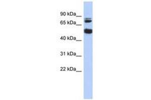 Image no. 1 for anti-Serine/threonine-Protein Kinase NIM1 (NIM1) (AA 143-192) antibody (ABIN6741236) (NIM1 anticorps  (AA 143-192))