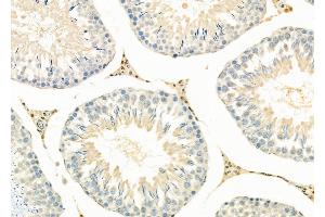 ABIN6264389 and ABIN6279692 at 1/100 staining Rat testis tissue by IHC-P. (PPP1R3D anticorps  (Internal Region))