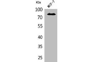 Western Blot analysis of MCF7 cells using IL-1RI Polyclonal Antibody (IL1R1 anticorps  (N-Term))