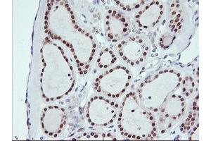 Image no. 9 for anti-Ubiquitin Specific Peptidase 10 (USP10) antibody (ABIN1501688)