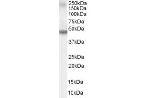 Image no. 1 for anti-Retinoic Acid Receptor, alpha (RARA) (C-Term) antibody (ABIN374531) (Retinoic Acid Receptor alpha anticorps  (C-Term))