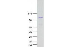 Validation with Western Blot