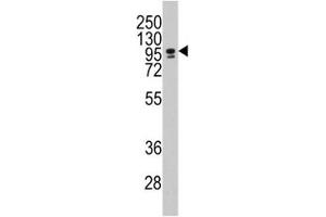 Western blot analysis of CEBPZ / CBF antibody and NCI-H460 lysate.