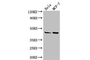 Western Blot Positive WB detected in: Hela whole cell lysate, MCF-7 whole cell lysate All lanes: MAP2K4 antibody at 3. (MAP2K4 anticorps  (AA 259-398))