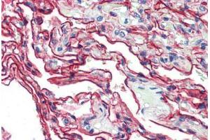 Human Lung (formalin-fixed, paraffin-embedded) stained with S100A10 antibody ABIN462133 followed by biotinylated anti-mouse IgG secondary antibody ABIN481714, alkaline phosphatase-streptavidin and chromogen. (S100A10 anticorps)
