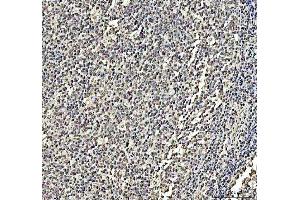 IHC analysis of DCK using anti-DCK antibody (ABIN5693016). (DCK anticorps  (AA 17-260))