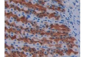 Detection of FGF1 in Rat Stomach Tissue using Monoclonal Antibody to Fibroblast Growth Factor 1, Acidic (FGF1)