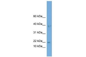 WB Suggested Anti-ARPC3 Antibody Titration: 0. (ARPC3 anticorps  (Middle Region))