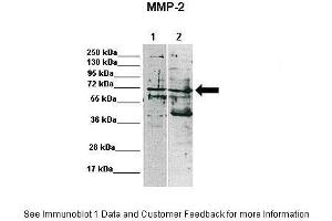 Lanes:   Lane 1: 15ug MDA-MB-231 lysate Lane 2: 15ug MCF7 lysate  Primary Antibody Dilution:    1:1000  Secondary Antibody:   Anti-rabbit-HRP  Secondary Antibody Dilution:    1:10,000  Gene Name:   MMP2  Submitted by:   Katarzyna Augoff, University of Wroclaw (MMP2 anticorps  (C-Term))