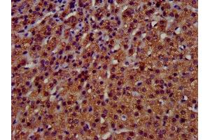 IHC image of ABIN7173123 diluted at 1:400 and staining in paraffin-embedded human adrenal gland tissue performed on a Leica BondTM system.