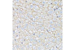 Immunohistochemistry of paraffin-embedded rat liver using CTNN antibody (ABIN7266134) at dilution of 1:100 (40x lens).