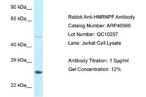 WB Suggested Anti-HNRNPF Antibody   Titration: 1. (HNRNPF anticorps  (C-Term))