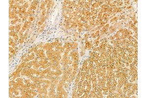 anti-Serum Amyloid A2 (SAA2) (Internal Region) antibody